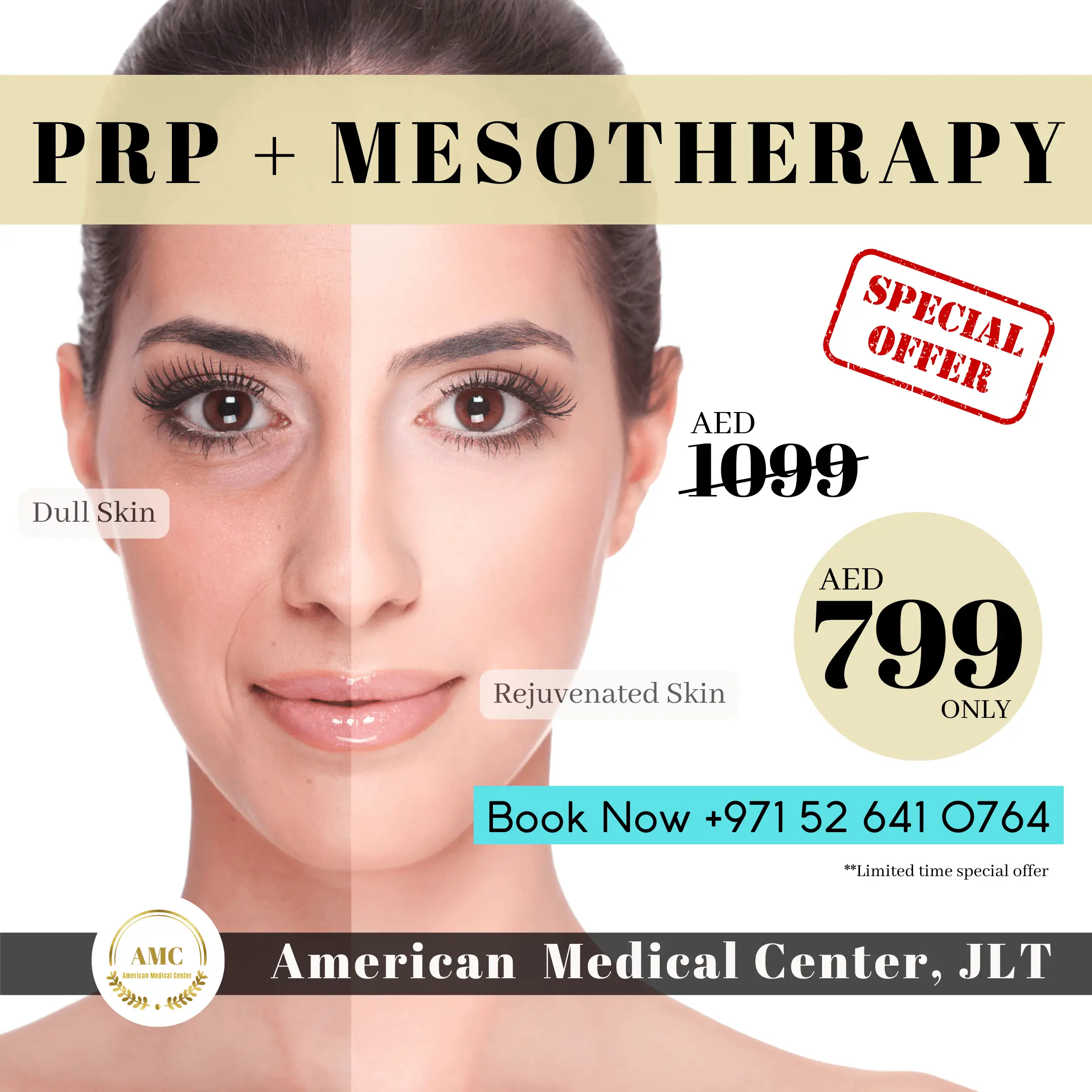 PRP in dubai, Mesotherapy in dubai, American Medical Center JLT.